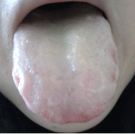 出汗多了该怎么调理,身体这4处常出汗要警惕