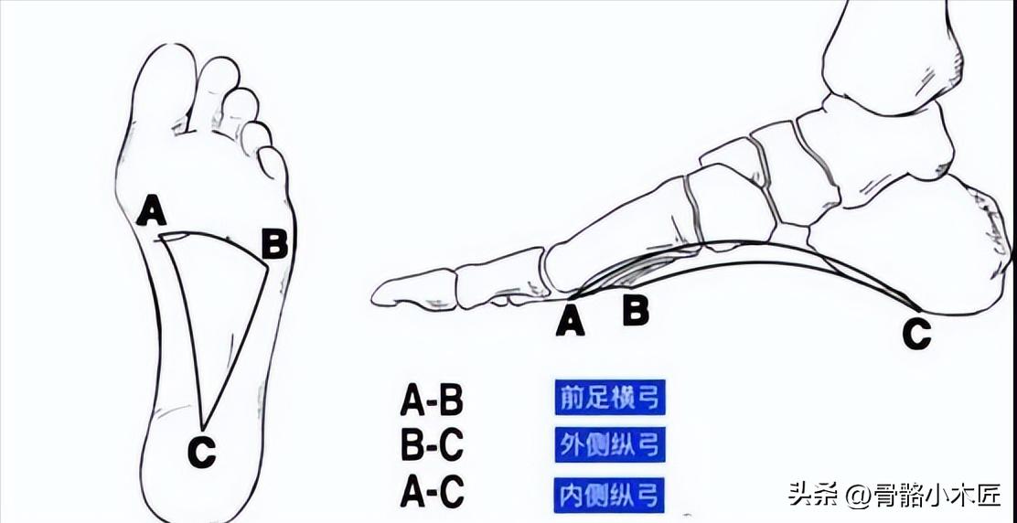 平足症疼痛的位置在哪,平足症