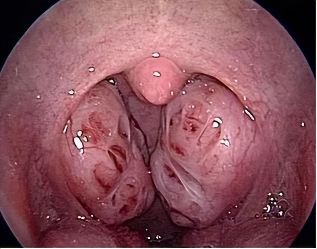 开展夏季送清凉冬季送温暖活动,送清凉送温暖活动