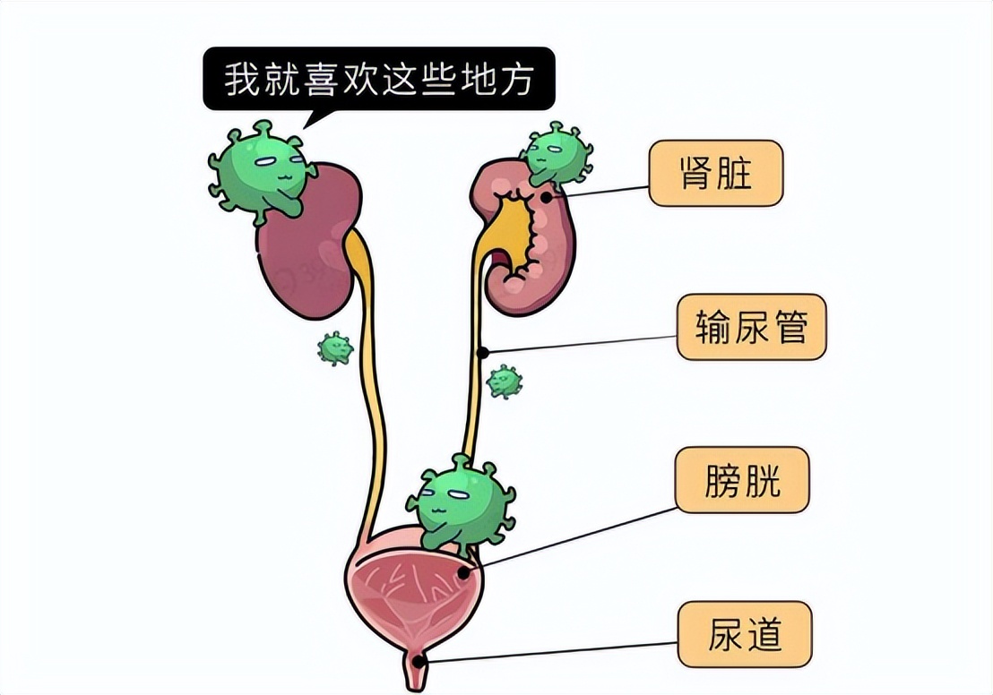 尿路感染最常见的致病菌有哪些,发生尿路感染最常见的感染途径是