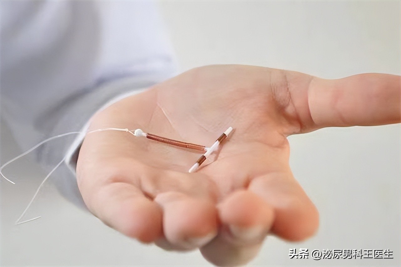 节育环多大年龄取出好取,节育环一直不摘