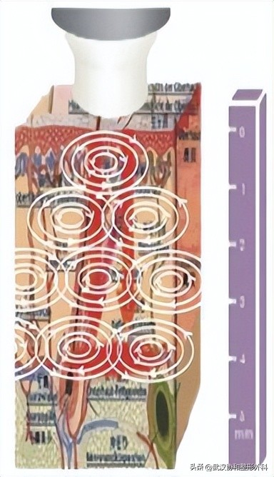 皮肤干燥痒痒起疹子怎么办,皮肤痒血燥是怎么引起的