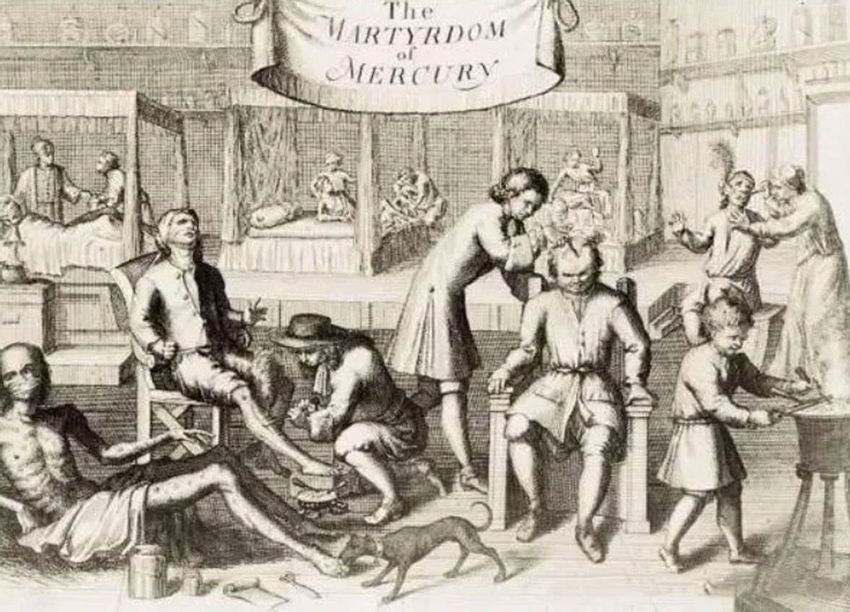 水银为什么能治疗梅毒,中世纪水银治疗梅毒