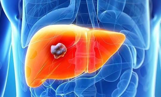 体检查出这9种病大多不用治,一次体检查出26种病这可咋办