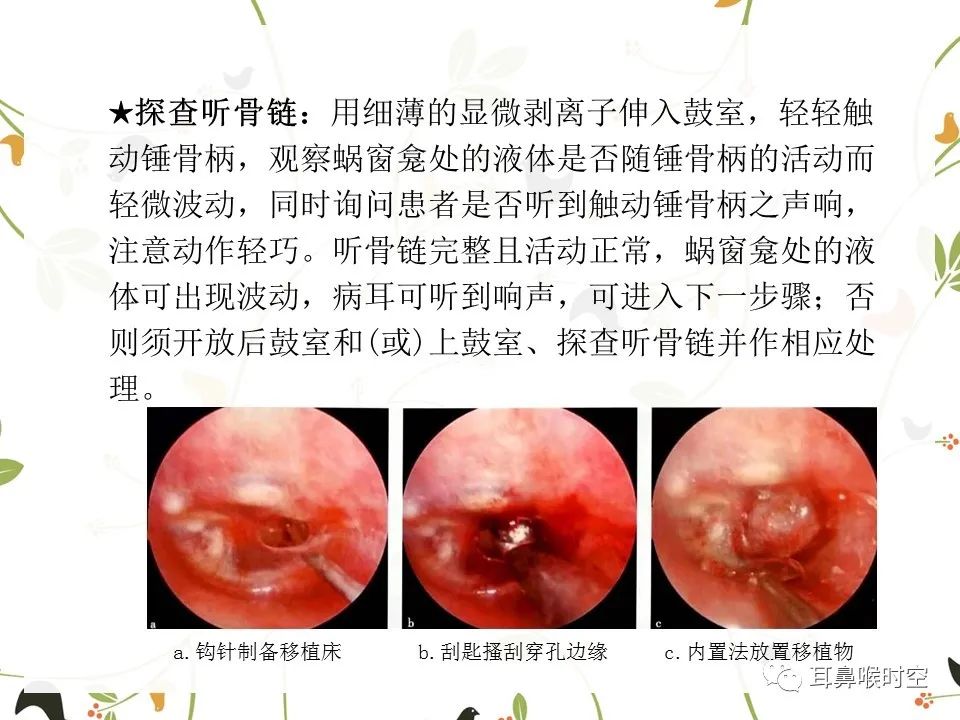 鼓膜可见穿孔,鼓膜穿孔听力下降能恢复吗