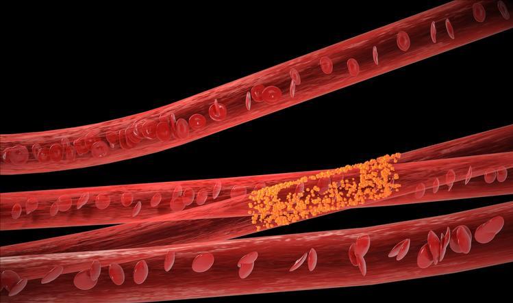 恶性肿瘤患者放疗期间吃点什么好,恶性肿瘤放疗后的注意事项