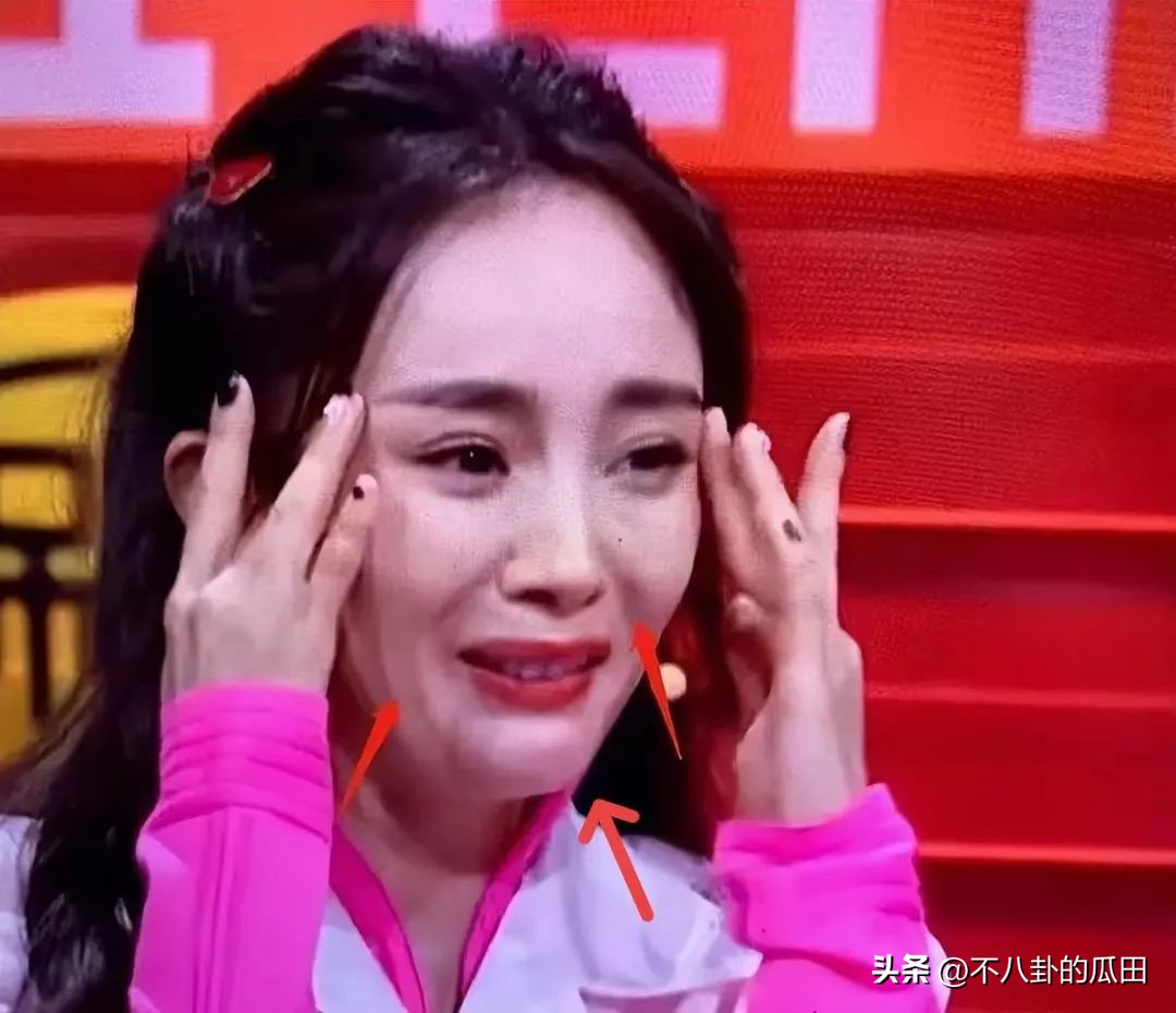 蔡徐坤下巴太尖惹争议图片,蔡徐坤下巴是假体吗