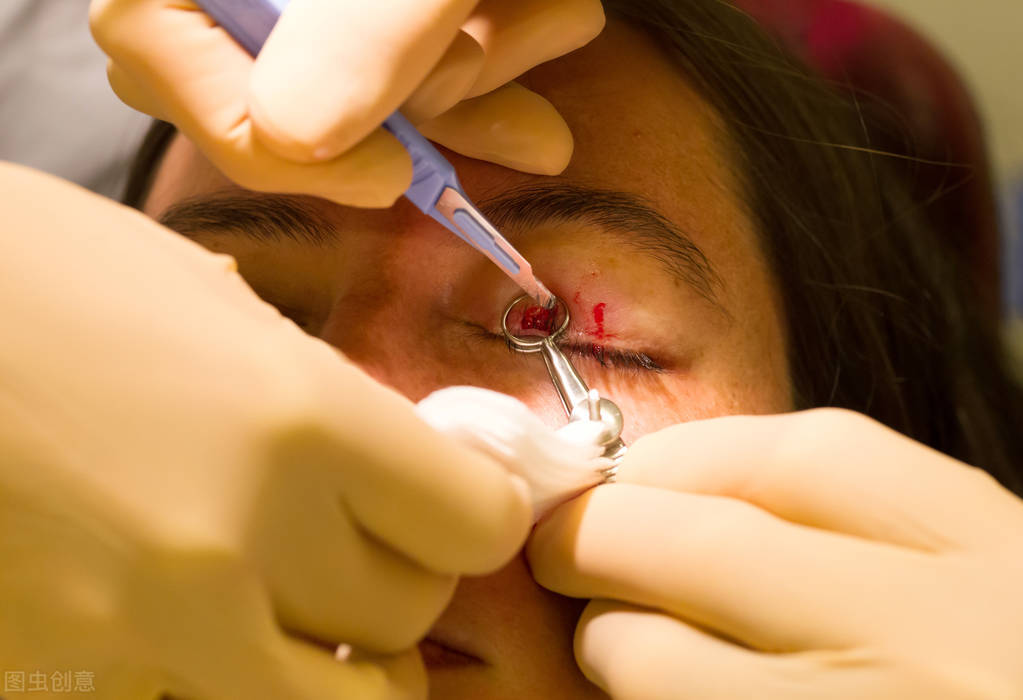 眼睑肿不消退怎么办,眼睑上长痘红肿