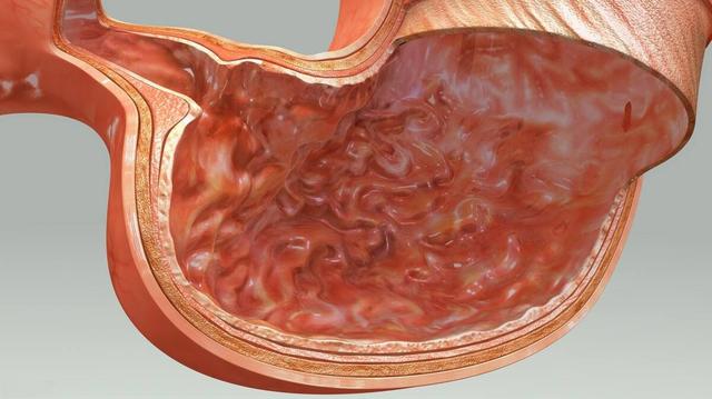 病理报告上肠息肉改变是什么意思,病理报告肠化生是不是萎缩性胃炎