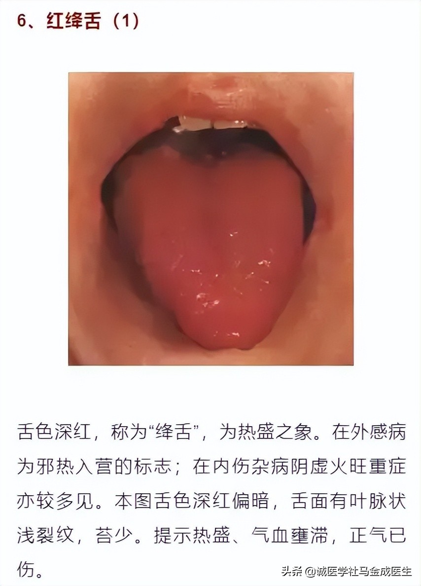吃六味地黄丸上火？什么人不适合吃六味地黄丸？怎么吃不上火呢？