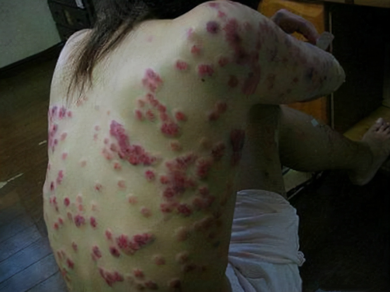 预防艾滋病最好方法改变危险行为,高危性接触怎么预防艾滋病