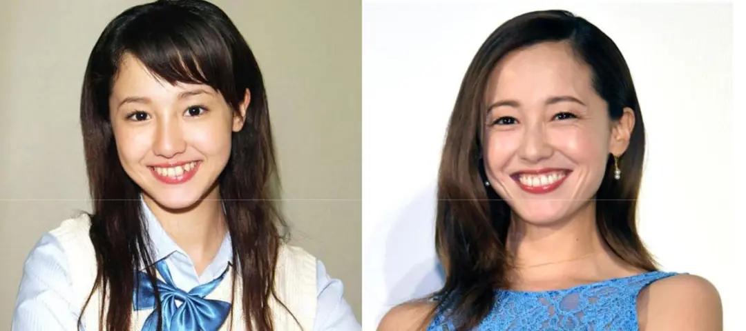 日本整牙的明星,日本整牙明星
