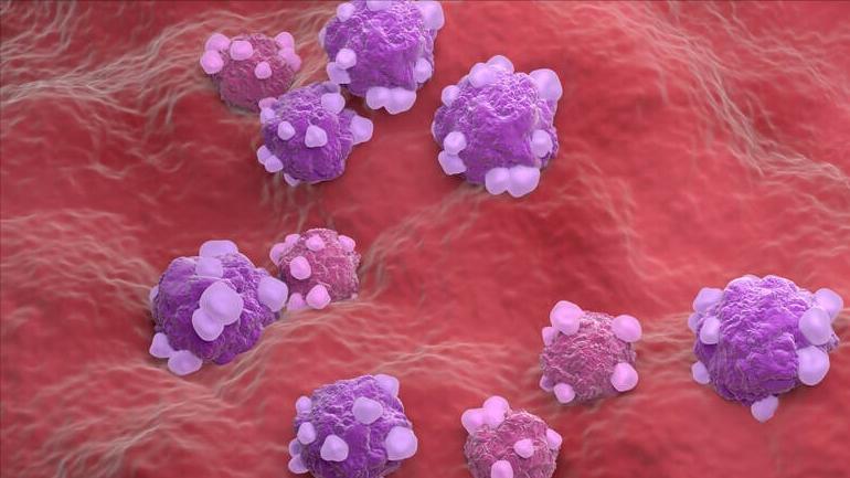 不要错把癌症当小毛病，身体出现2种情况，或是子宫内膜癌的信号