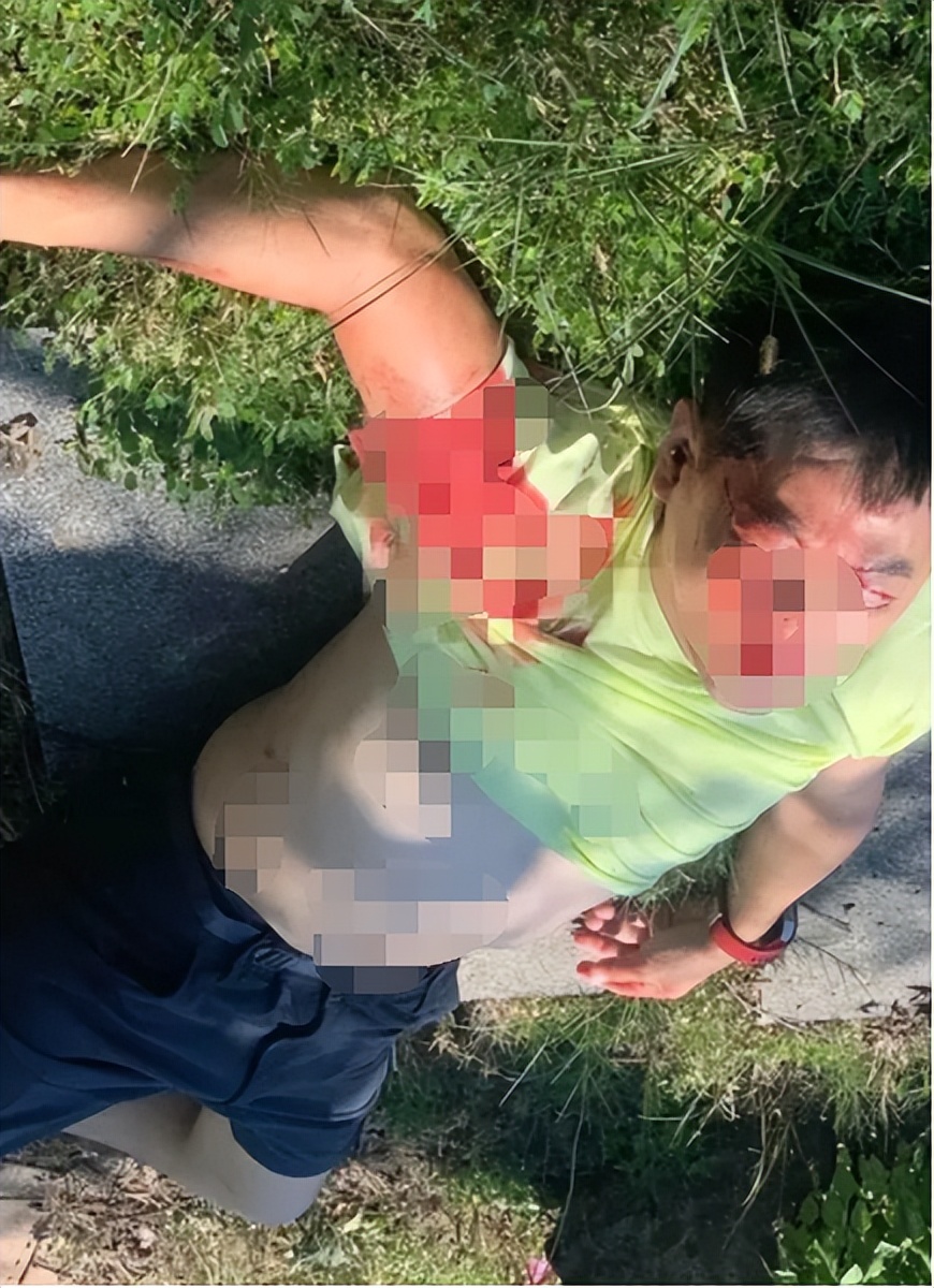 林志颖开特斯拉车祸后伤势严重!面部骨折做整容手术,儿子受惊吓