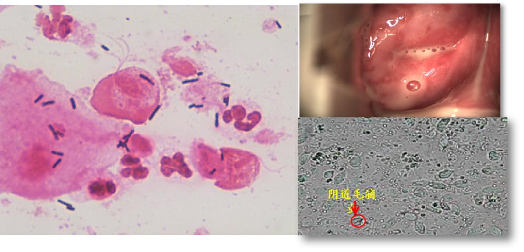 派特灵生物,派特灵生物讲解