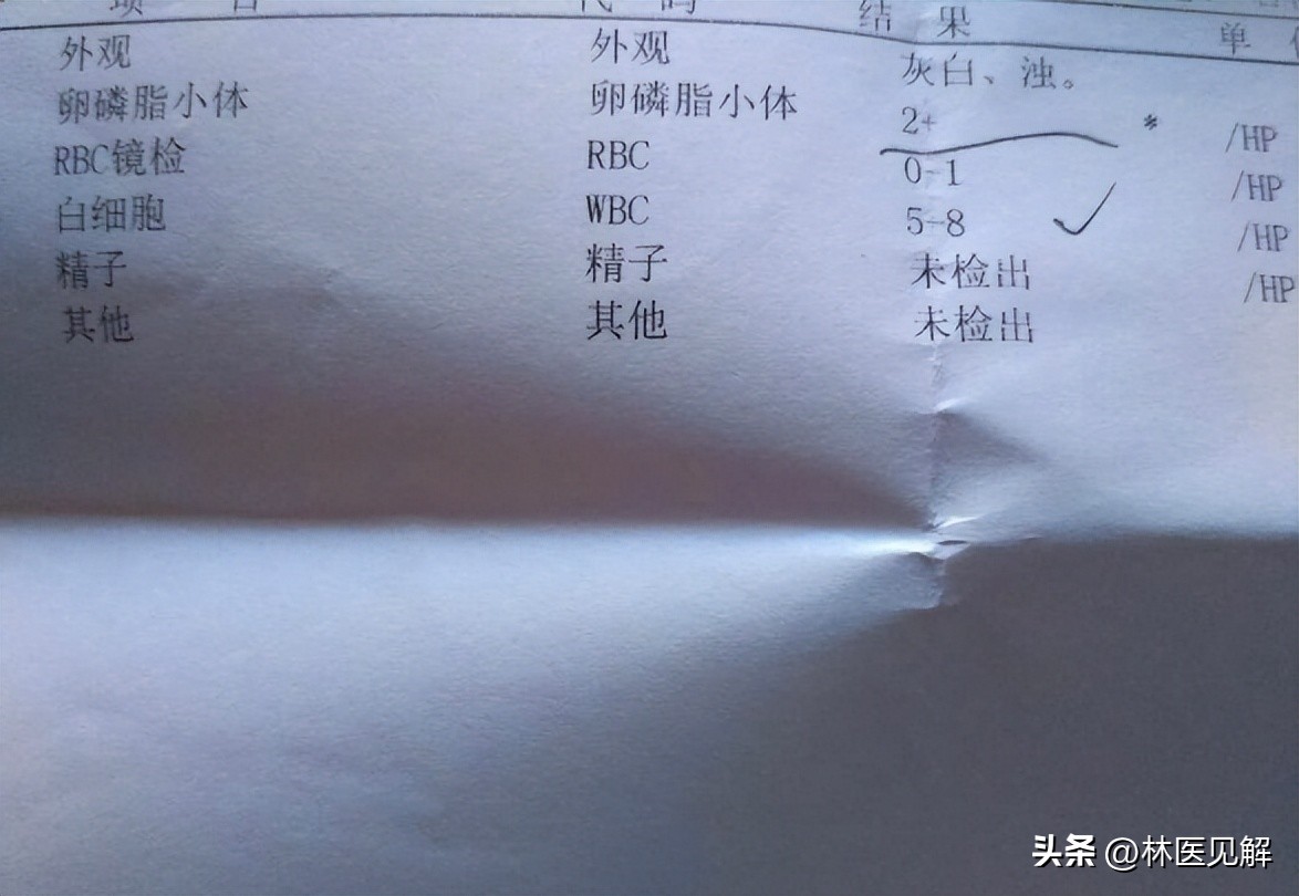 前列腺炎导致气血运行不畅,气血瘀滞型前列腺炎中医怎么治