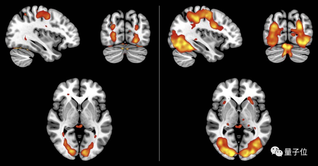 分不清梦和现实用好久才想清楚,分不清梦和想象