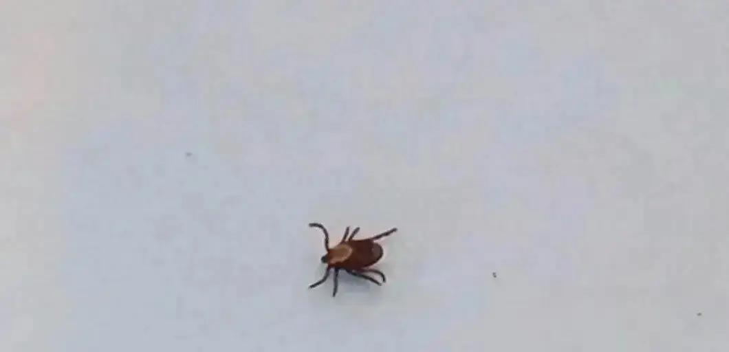 宁波一女子上完坟后发现气道壁上缀菌