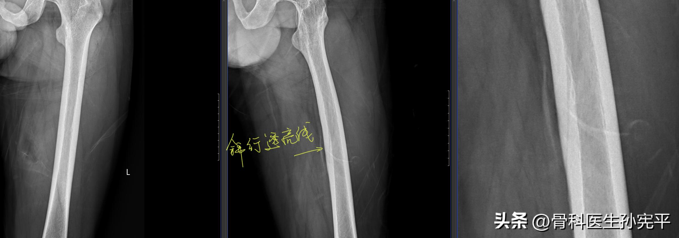医学影像趣图,震撼的医学影像