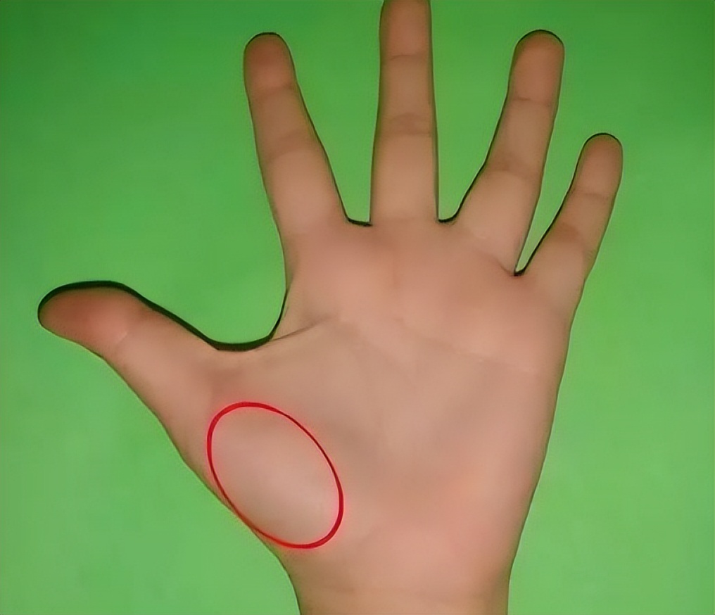 胳膊青筋手背青筋多是怎么回事,人体青筋明显是什么问题