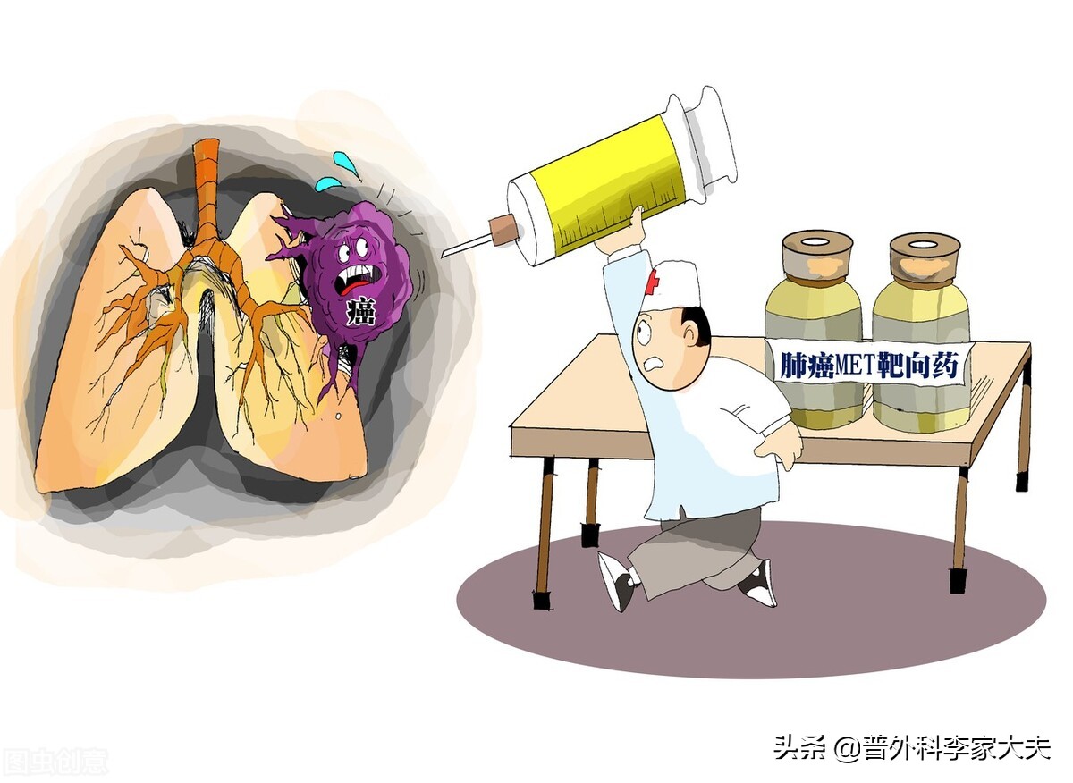 肺癌晚期转移淋巴结能完全治愈吗,从一期肺癌到二期肺癌发展时间