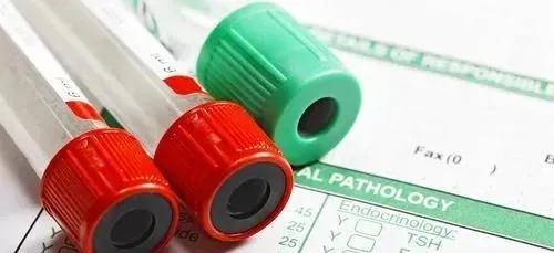 肌酐升高不做穿刺能确定病因吗,肌酐突然高能治好吗