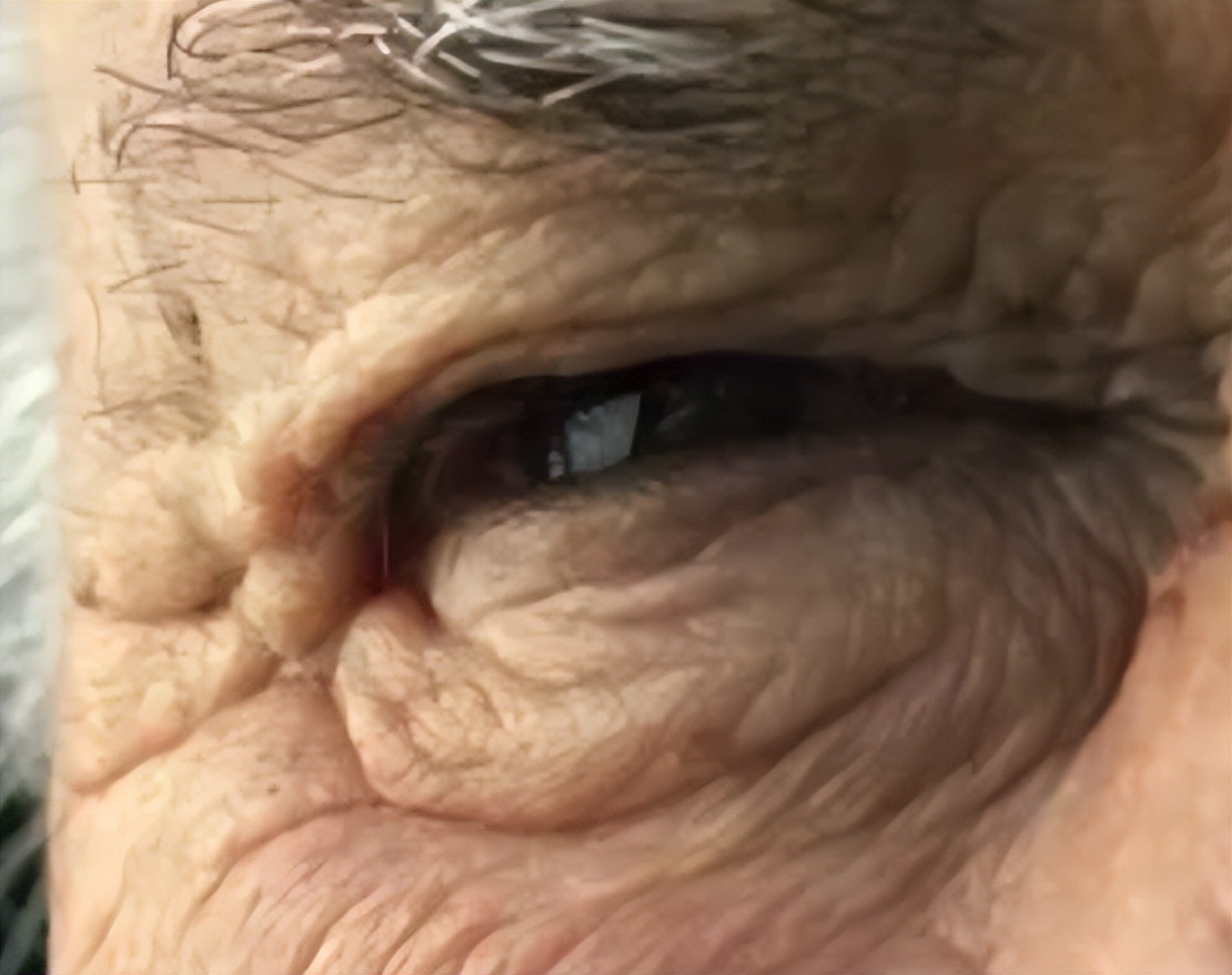 揭秘男性衰老的10大征兆,男性衰老最明显的征兆