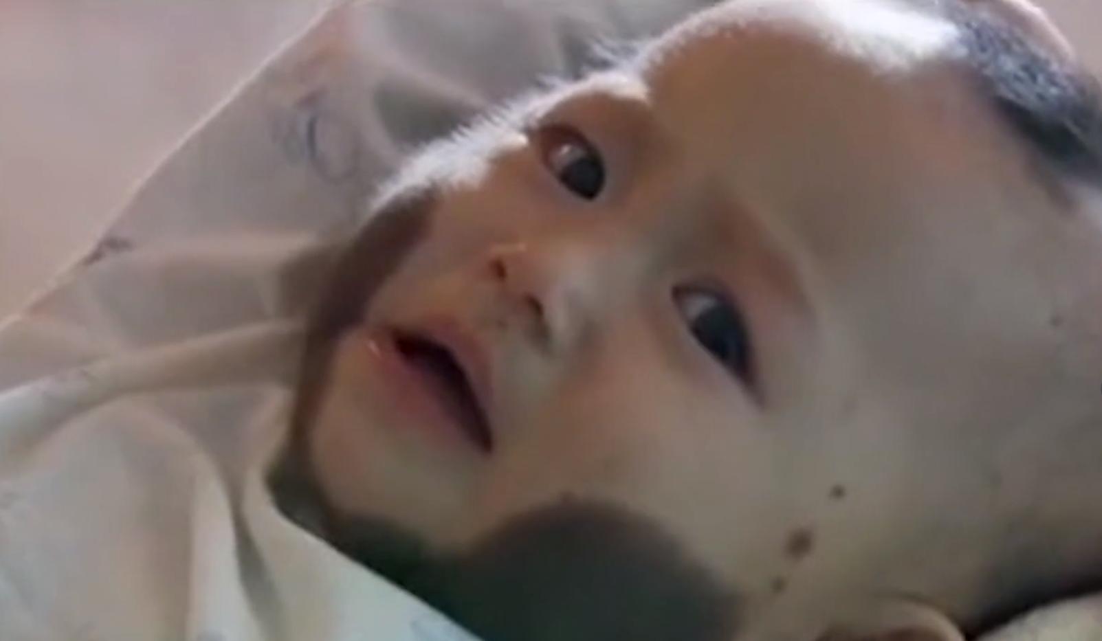 刚出生的小孩皮肤有黑斑,全身长满黑斑的小孩后来怎样了