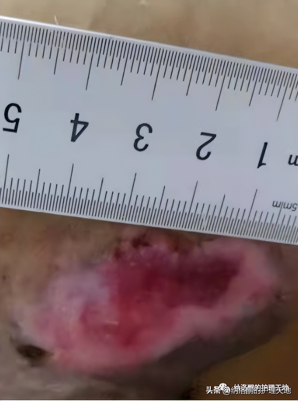 康复新液恢复创面效果怎么样,康复新液可以治疗胃不舒服吗