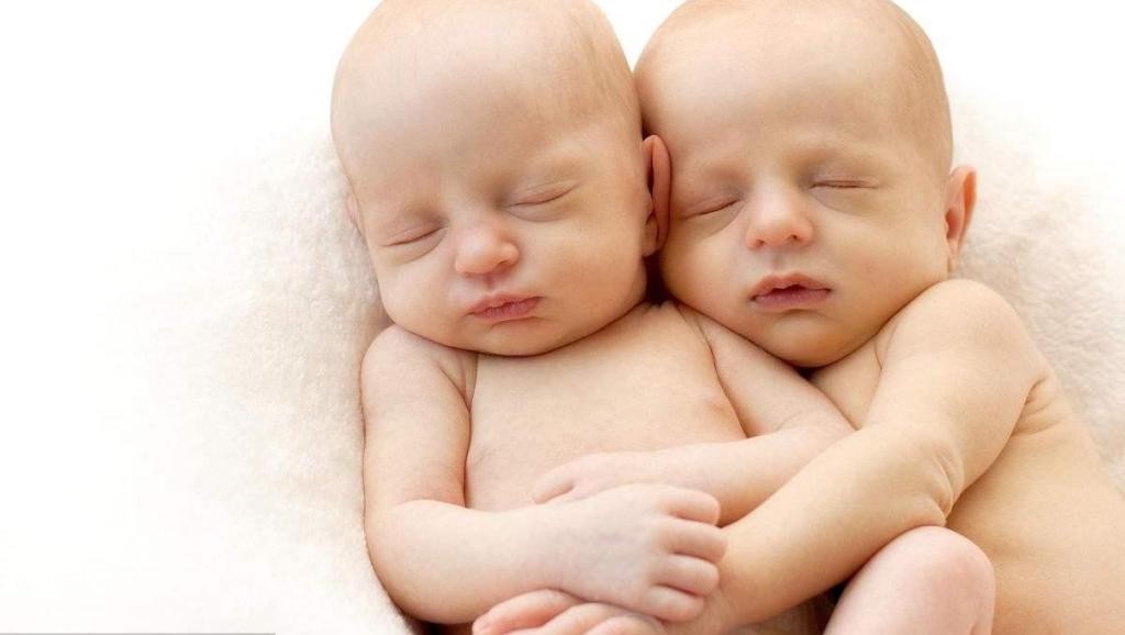 连体兄弟真的存在吗,印度连体兄弟被奉为神灵不想分离