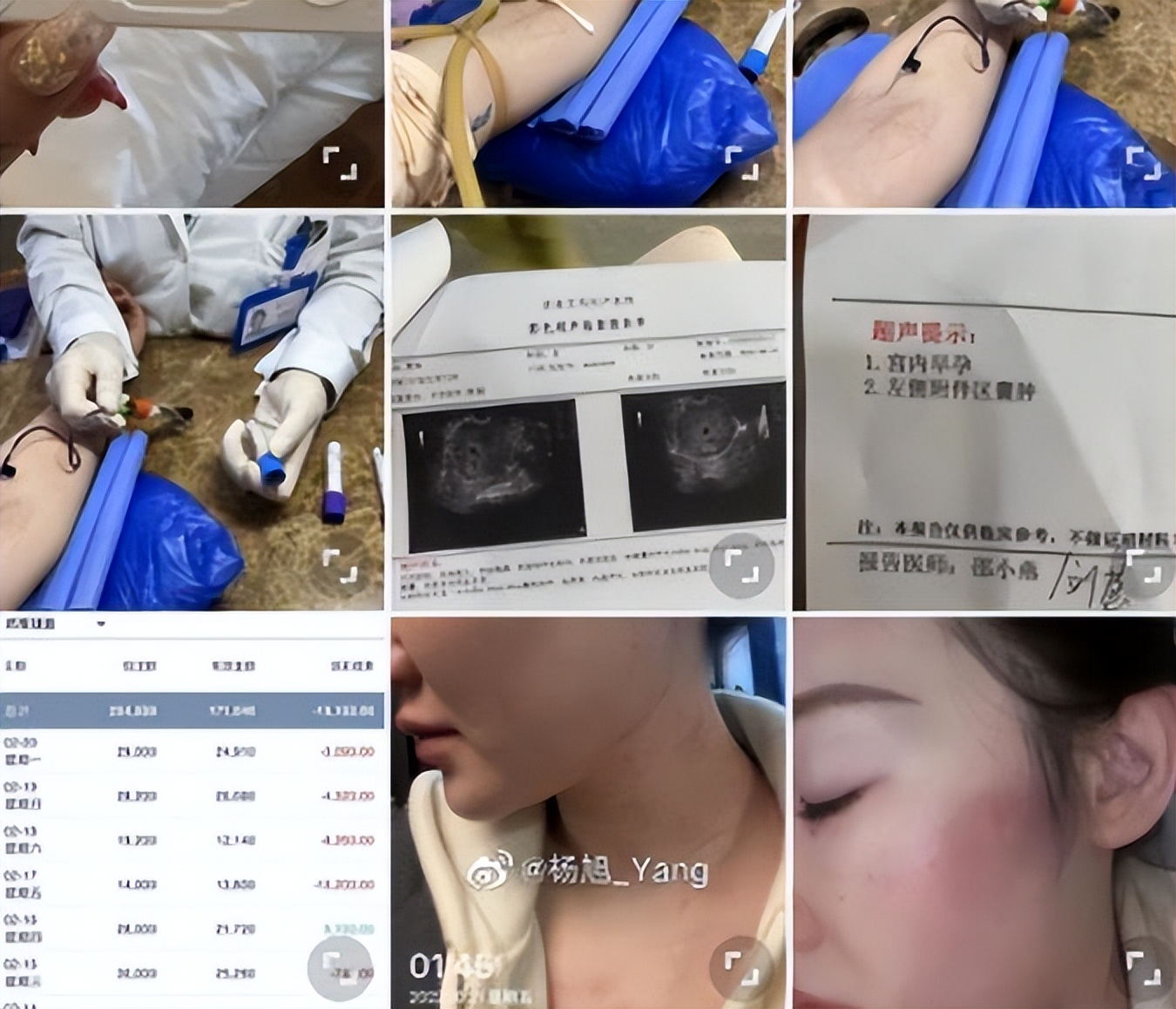 cba鐞冨憳涓戦椈浜嬩欢,cba涓戦椈浜嬩欢