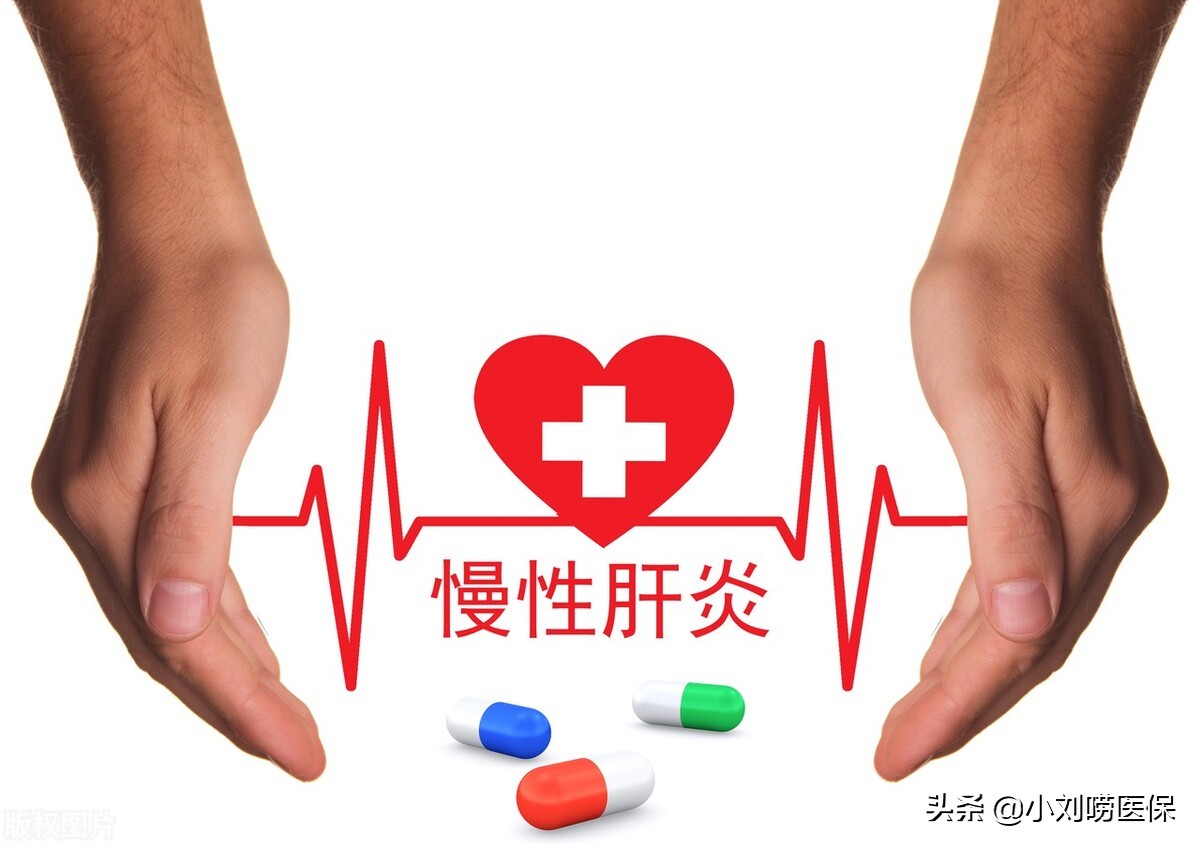 肝脏病情发展三部曲都能申请慢性病,申请条件和医保报销范围如下