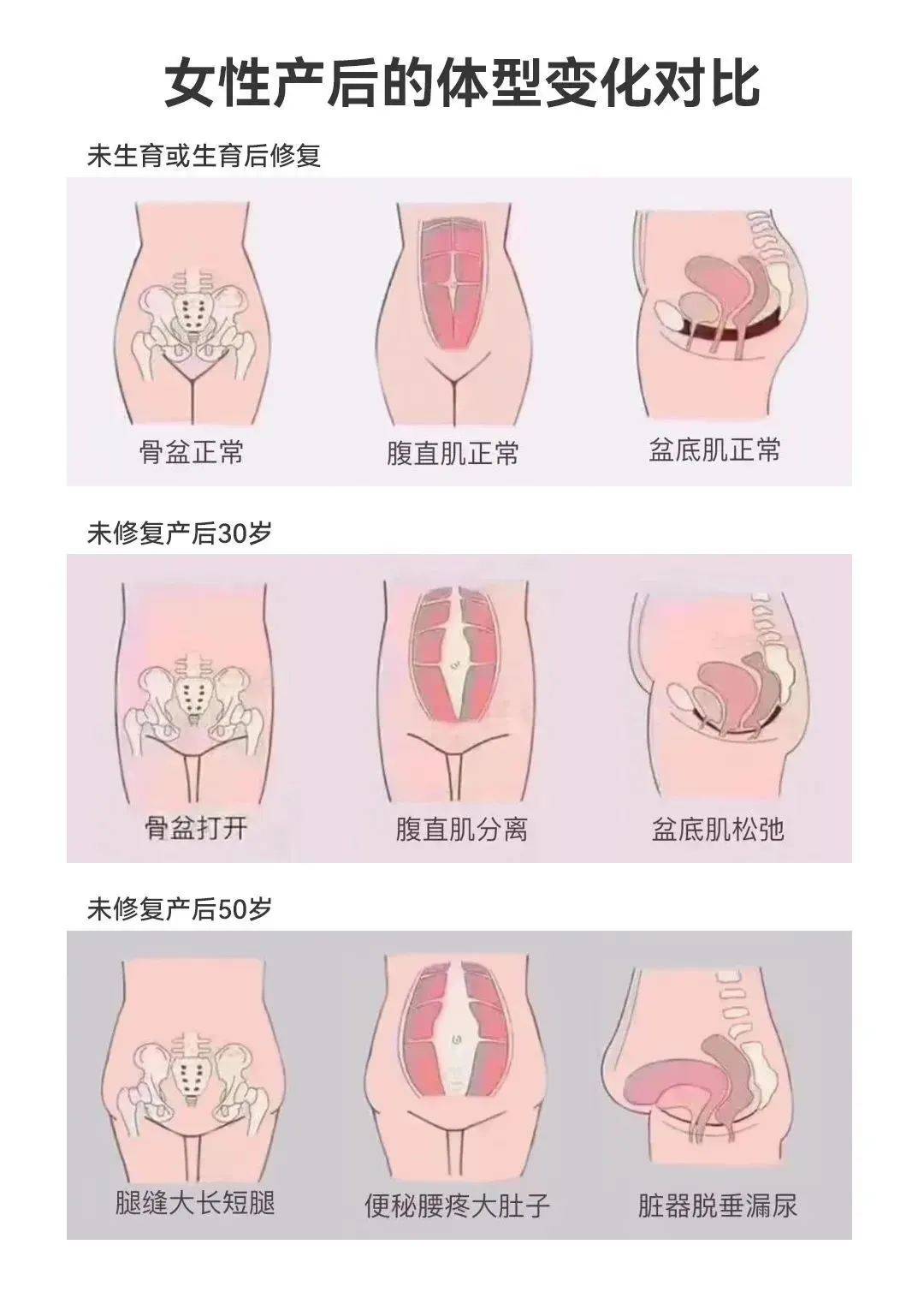 产前瑜伽与产后瑜伽,瑜伽笔记模板