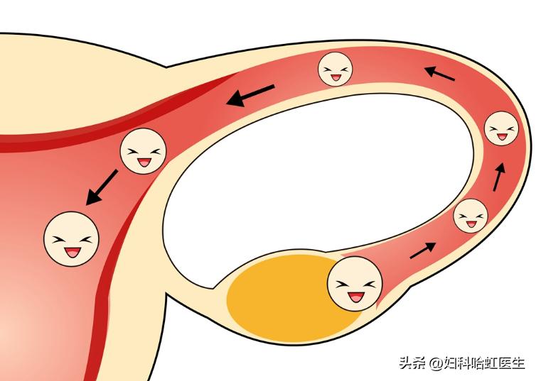 输卵管积液堵塞可以治愈好吗,左侧输卵管伞端堵塞能治愈吗