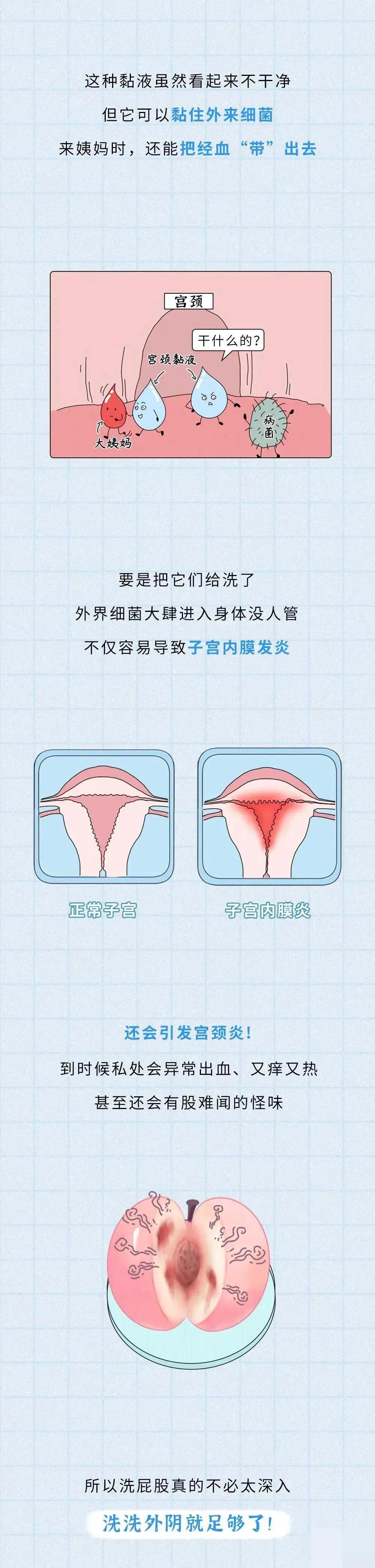 女生如何做私部护理,女生应该做哪些护理