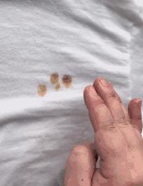 白衣服污垢洗不掉怎么能去除,衣服上面溅了油怎么洗掉