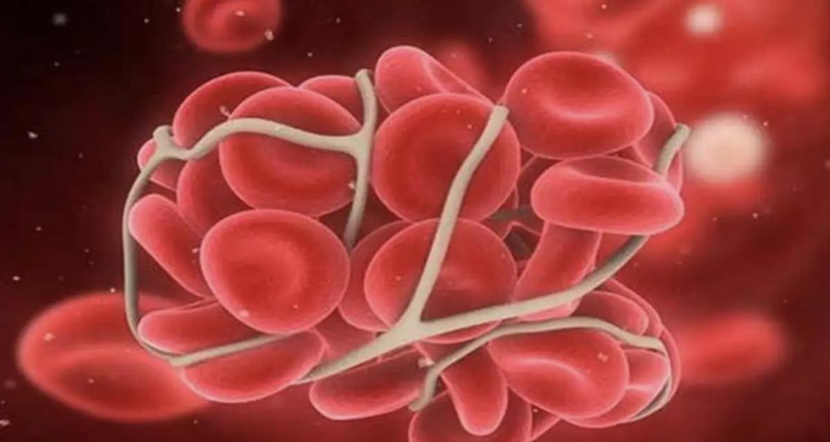 全球不到100例的疾病,史上最罕见的熊猫血