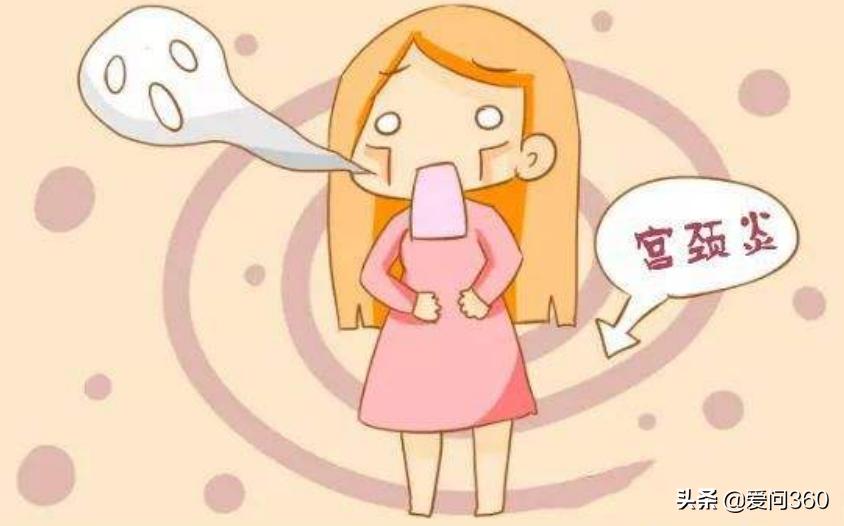 日常出现这些问题可能是宫颈炎,不要大意,做好预防措施