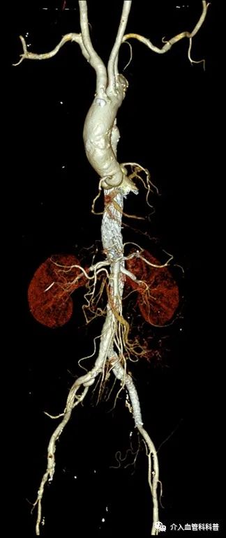 南昌二附院血管外科专家,南昌大学第二附属医院周卫