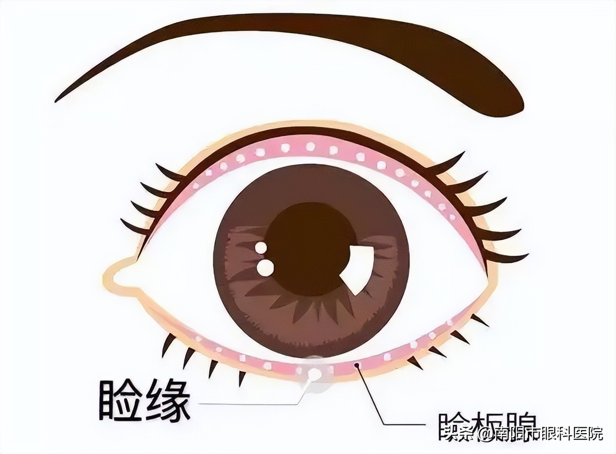 干眼诊疗,眼科专家干眼症