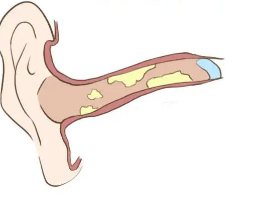 肚脐眼的黑泥到底可不可以抠,人体的秘密全部视频