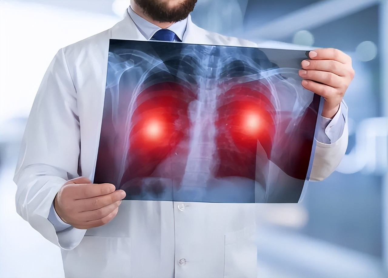 胸口沉闷隐痛是怎么回事,胸口疼胸闷检查没事是什么原因