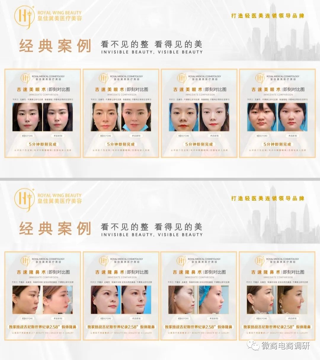 不手术不开刀无痛丰胸,不手术不开刀无痕丰胸