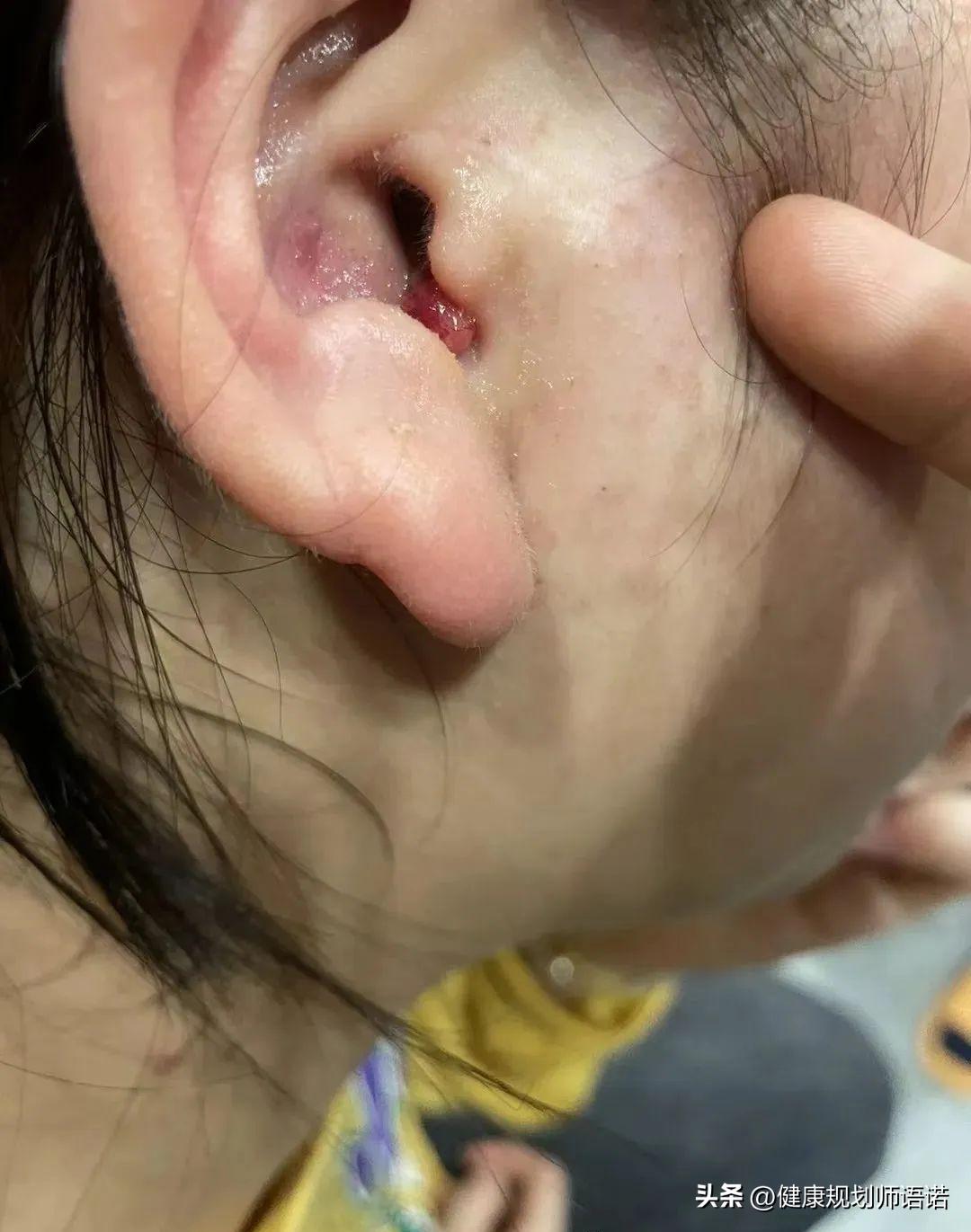 因宫颈问题走进阳光森林，用营养拯救了整个家族的健康