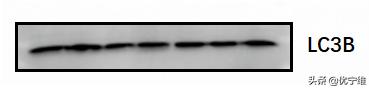 lc3自噬标记物,lc300有哪些隐藏功能