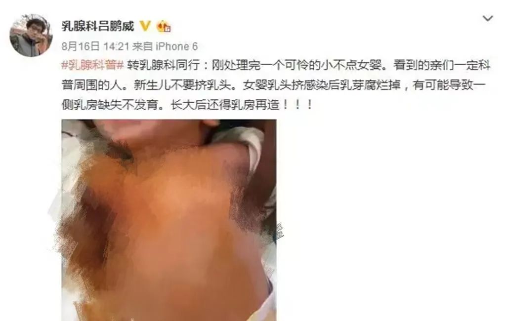 胸部的乳头有小疙瘩,男性乳头长疙瘩发痒
