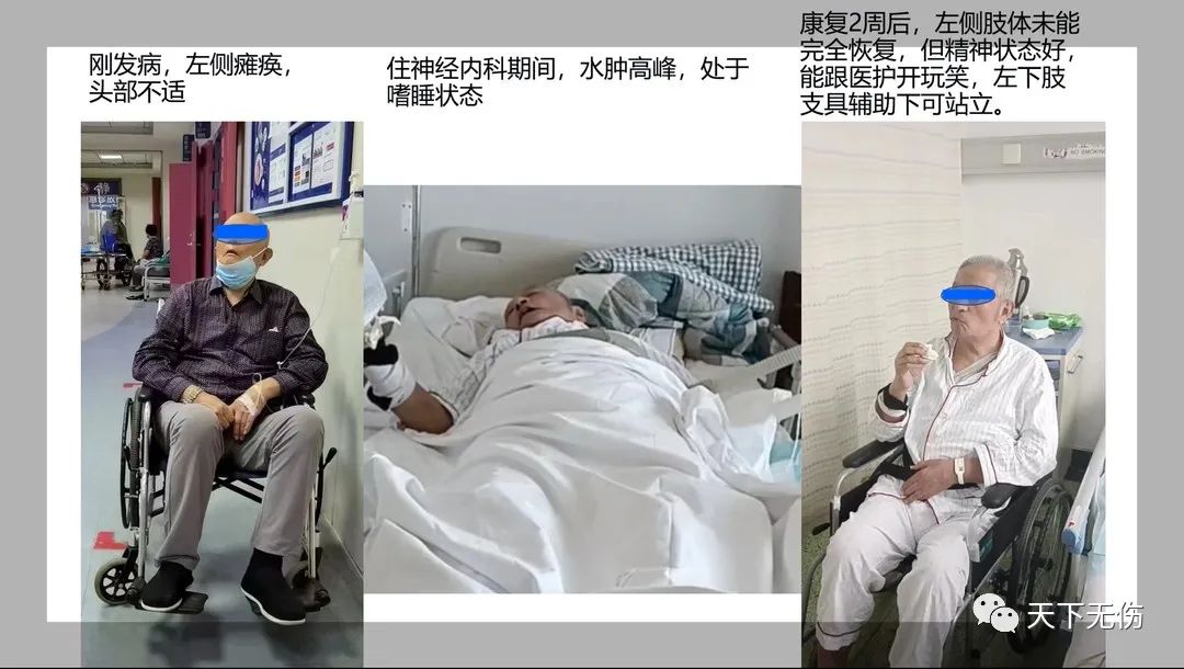 神经康复简介,坐骨神经康复操