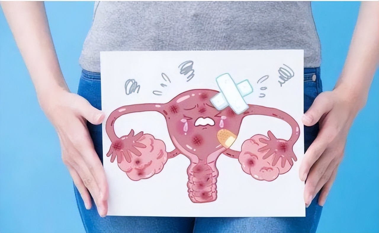 月经出现这4种异常,月经出现问题需要做哪些检查