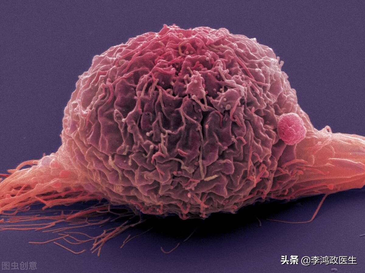 女子腰椎突出腰痛,女子腰椎间盘突出