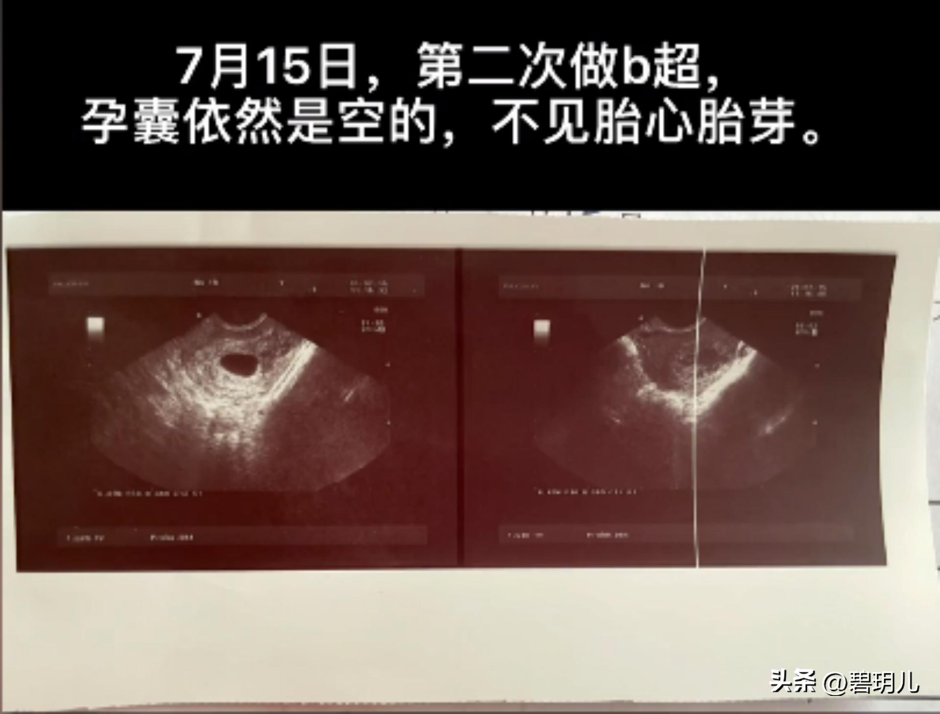 潘潘的老公是谁,潘潘的男朋友长什么样